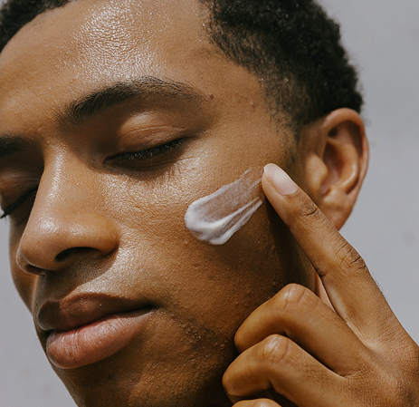 Acne & Acne Scarring