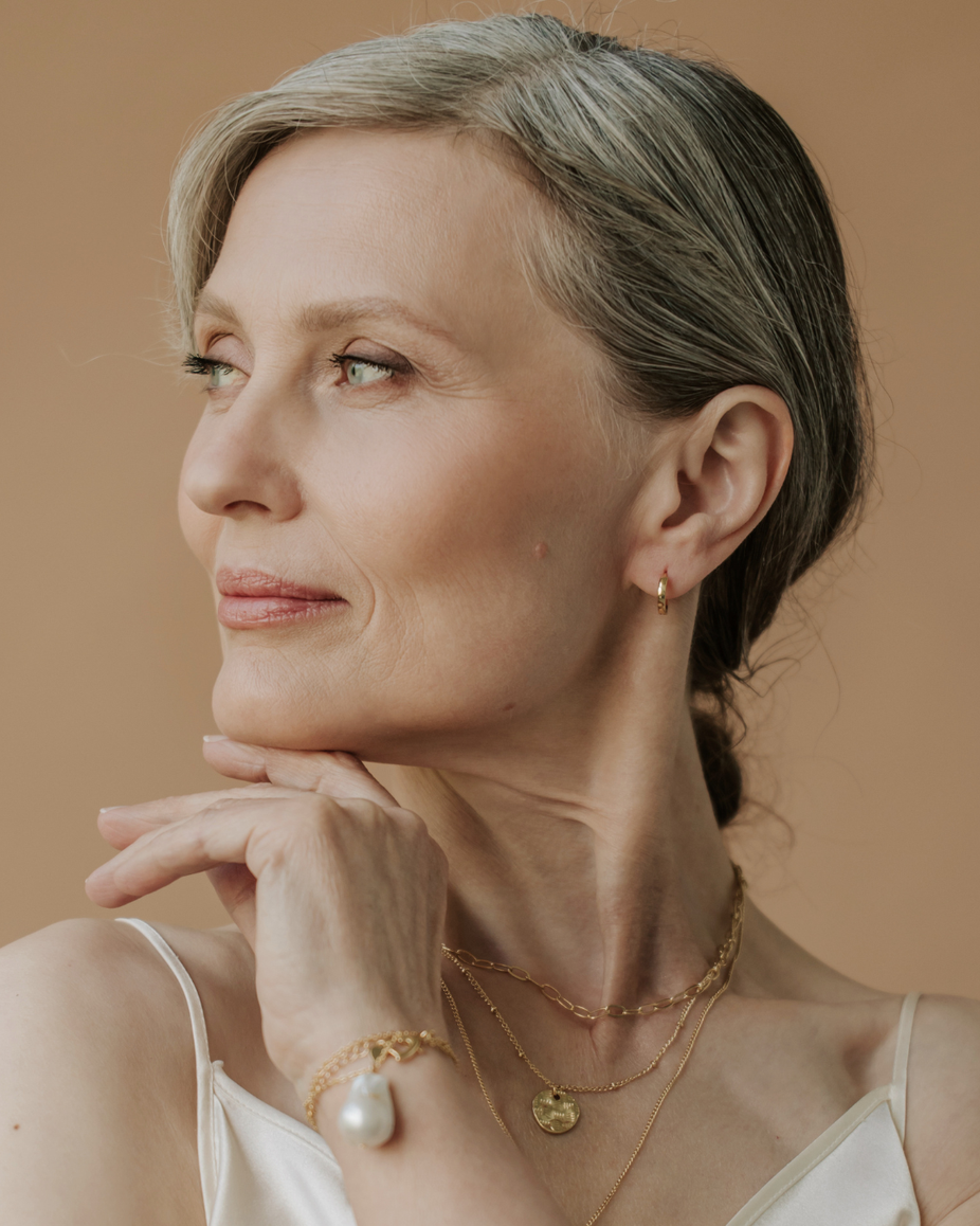 Sculptra treatment